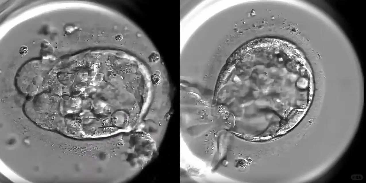 供卵试管保险理赔指南：医疗险覆盖范围与报销详情